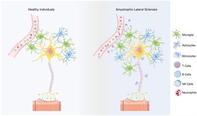 Immunology of amyotrophic lateral sclerosis – role of the innate and adaptive immunity